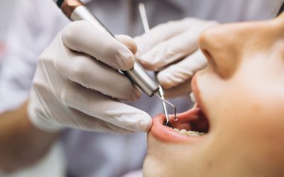 periodoncia zaragoza y huesca
